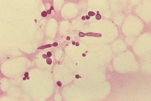 Malassezia grybelio mikroskopinis vaizdas