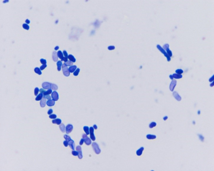 Malassezia grybelio mikroskopinis vaizdas2